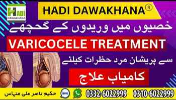 #Varicocele Ka ilaj | Varicocele Symptoms and Treatment in Urdu | Varicocele Medicines in Pakistan