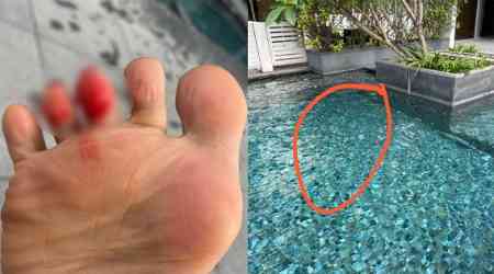 Woman cuts toe on pool tiles, calls out Chinatown hotel employee's 'nonchalant' attitude 