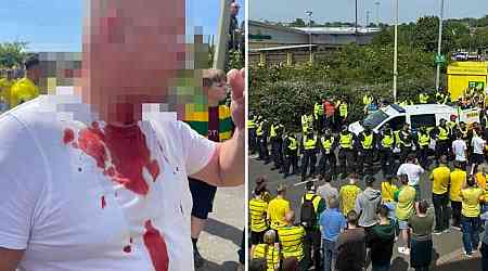 Leeds fan 'slashed in neck' outside Carrow Road after Norwich play-off semi-final