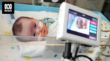 Neonatal cot cameras let families livestream sick and premature babies around the clock