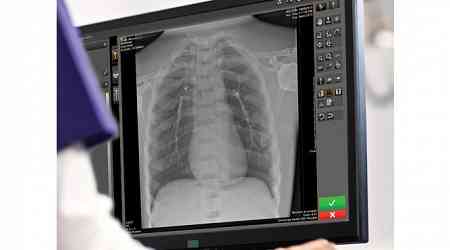 Carestream Introduces Image Suite MR 10 Software to Enhance Imaging Experience for CR and DR Imaging Systems