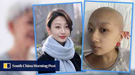 Hairless cancer-hit China woman uses AI to soften looks blow for grandmother