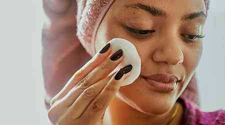  Your Ultimate Guide to Treating Acne and Preventing Pimples 