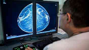 What your mammogram can tell you about your cardiovascular health