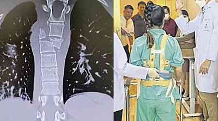 SQ321 turbulence: Malaysian woman, 23, walks again after suffering fractured spine