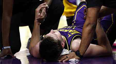  Lakers' Austin Reaves takes scary fall vs. Thunder, but returns to game after stint in locker room 