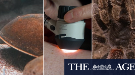 Scientists using spiders and crabs to fight melanoma