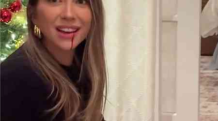  Stassi Schroeder Accidentally Stabbed in the Face by Daughter, 3 