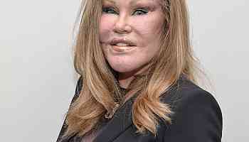 
                        Jocelyn Wildenstein, Known for "Catwoman" Transformation, Dead at 84
                