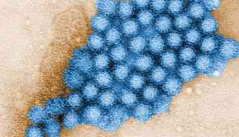 Norovirus cases are on the rise. Here's what you need to know about this nasty bug