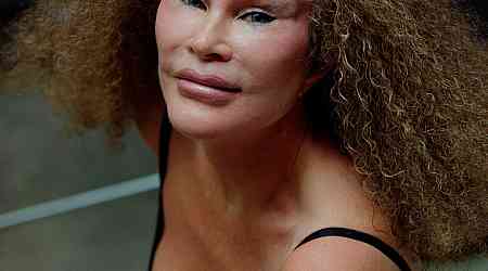  Everything to Know About "Catwoman" Jocelyn Wildenstein 