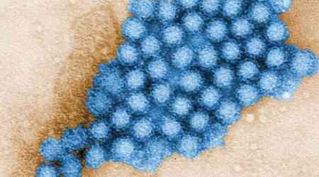 Norovirus cases are on the rise. Here's what you need to know about this nasty bug