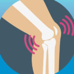 Cracking Joints: Why Your Joints Pop and When You Need To Worry