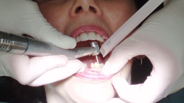 B.C. woman wins $15K in damages for 'serious pain and suffering' caused by dentist 
