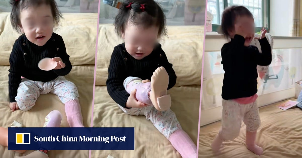 China toddler with 1 leg puts on own prosthetic leg for first time as mother cheers on, melting hearts on social media