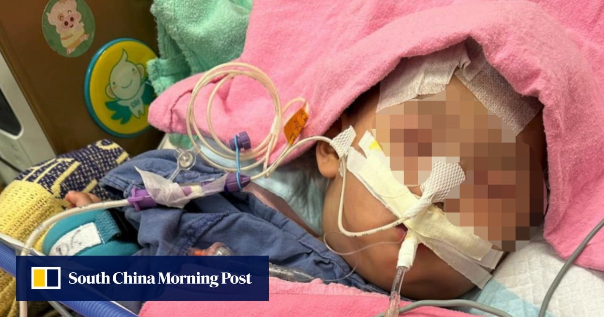 Hong Kong infant allegedly physically abused by babysitter could be left paralysed and blind, family says