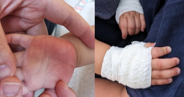Mum accuses preschool of negligence after 11-month-old boy burns hands on hot surface