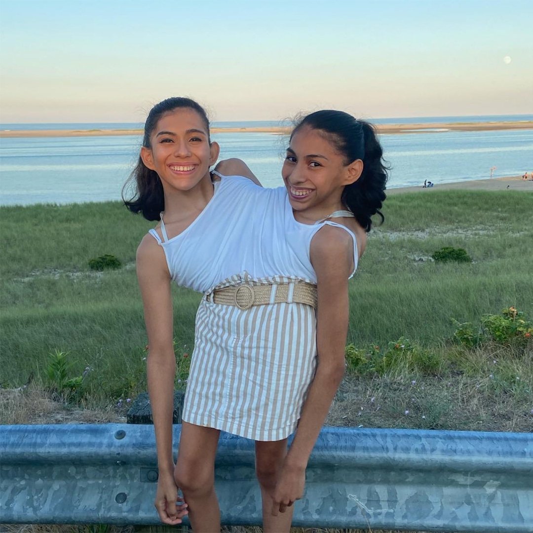  Conjoined Twins Carmen & Lupita Address Dating, Sex, Dying and More 