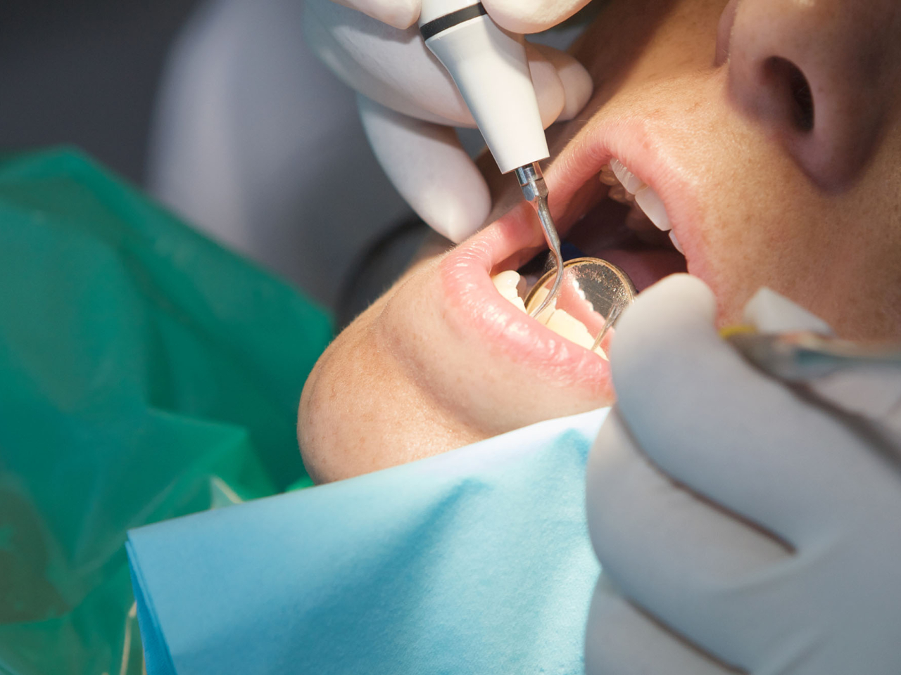 Emergency appointments halved amid dentist shortage