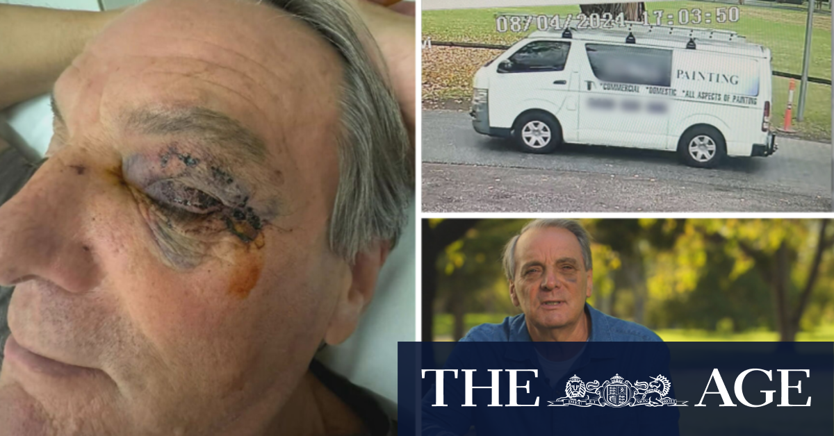 Grandfather who was allegedly coward punched feared for his life