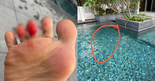 Woman cuts toe on pool tiles, calls out Chinatown hotel employee's 'nonchalant' attitude 