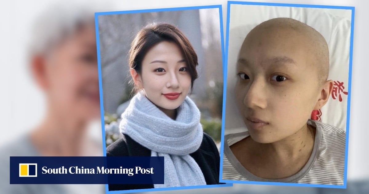 Hairless cancer-hit China woman uses AI to soften looks blow for grandmother