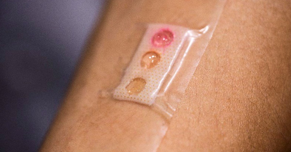 This tiny patch could be the future of wearable technology