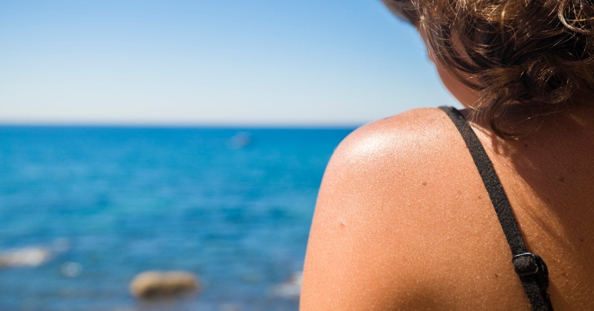 Why Sweat and Heat Make Your Skin So Sensitive