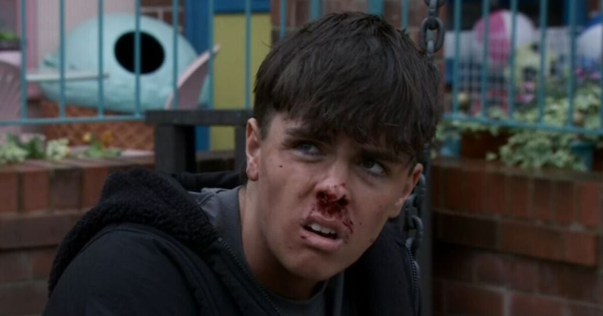 Coronation Street Mason's attacker revealed as he's left bloodied in shock attack