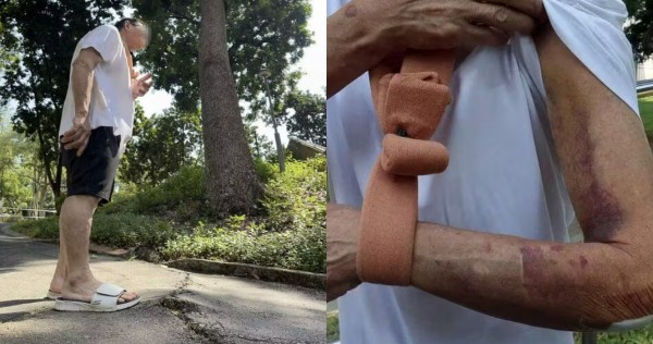 Man, 61, fractures shoulder after tripping over cracked path at Bukit Purmei park