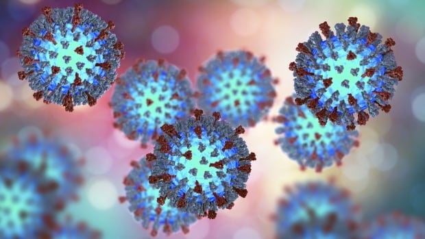 Measles exposure notice issued after confirmed case in Moncton, N.B.