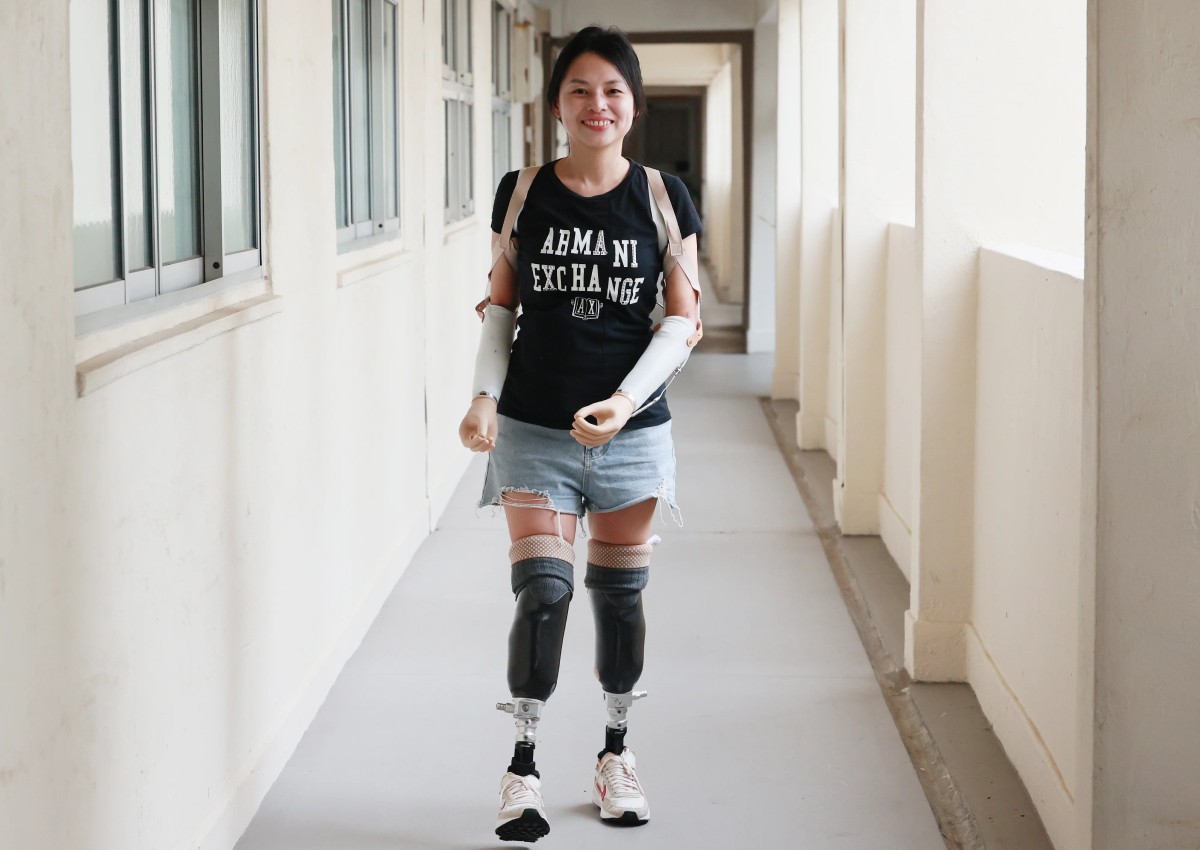 'I look forward to going back to work': Woman happy with new prosthetic arms after losing limbs to infection 