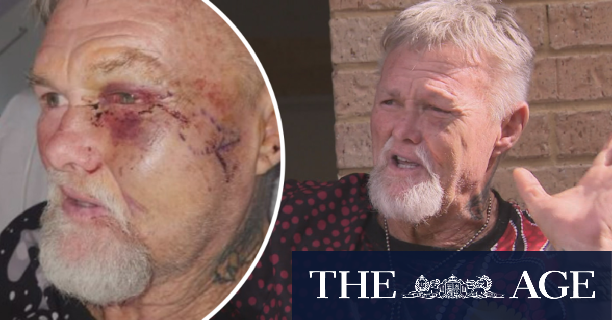 Perth grandfather needed metal plates in face after alleged bashing