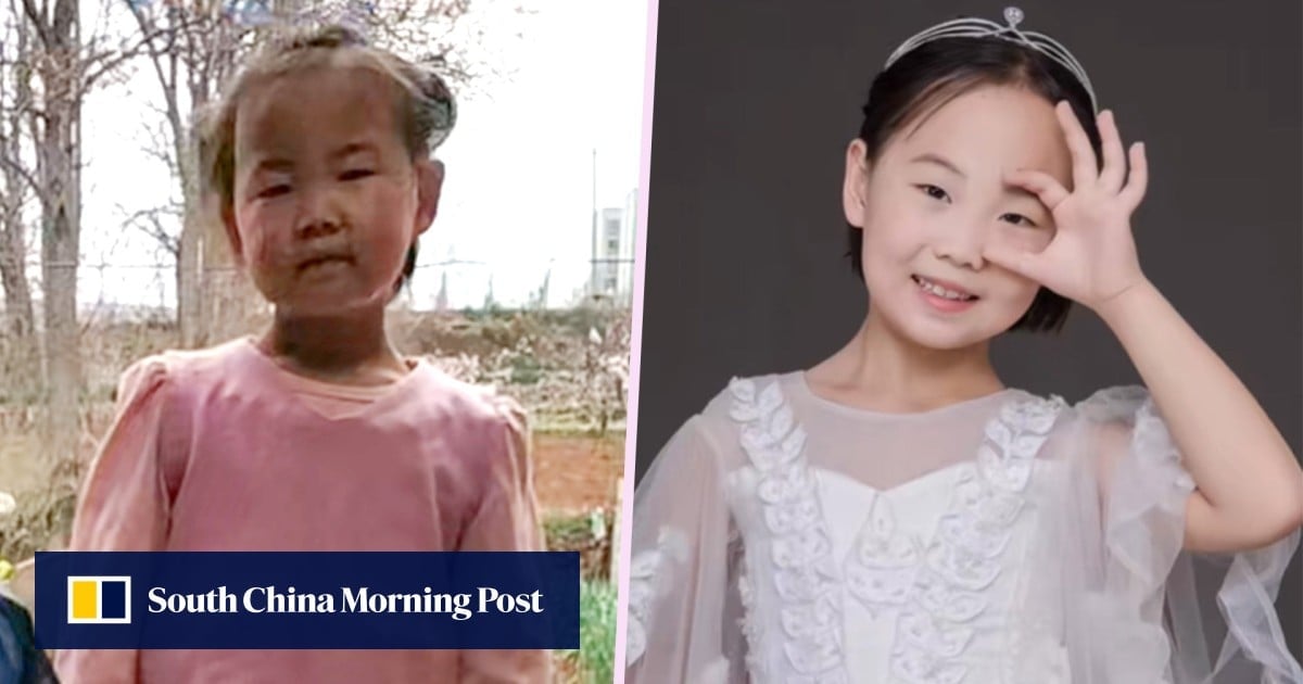 Stepmother unconditional love transforms lice-infected China girl into confident youngster
