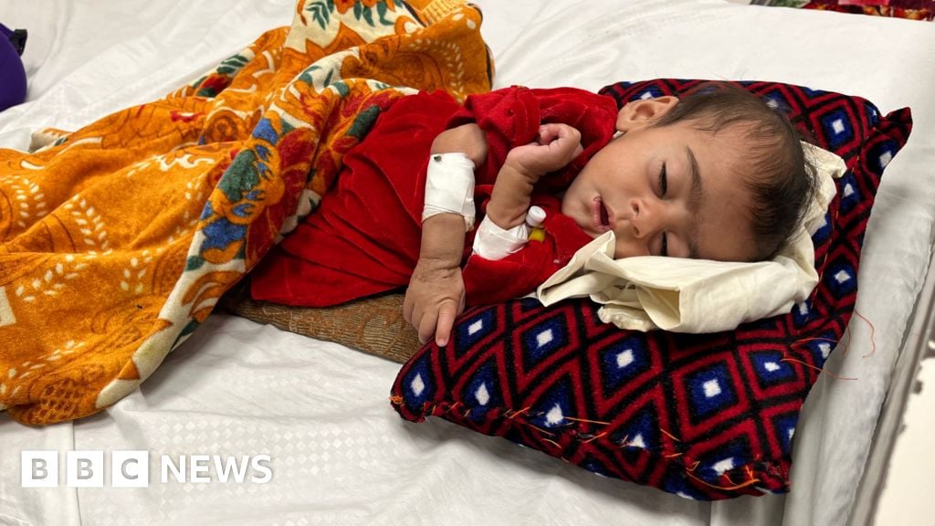 Afghanistan: Babies dying as malnutrition disaster unfolds