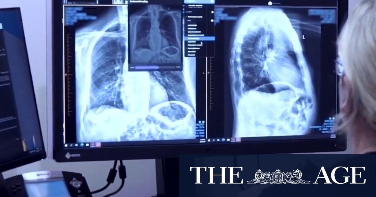 AI helping doctors diagnose cancers