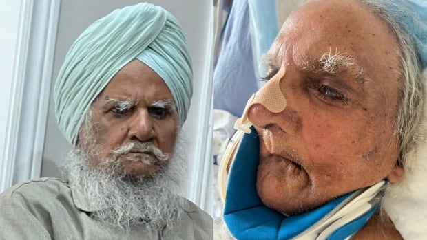 Brampton, Ont., hospital 'violated' Sikh man by shaving him without consent, advocacy group says