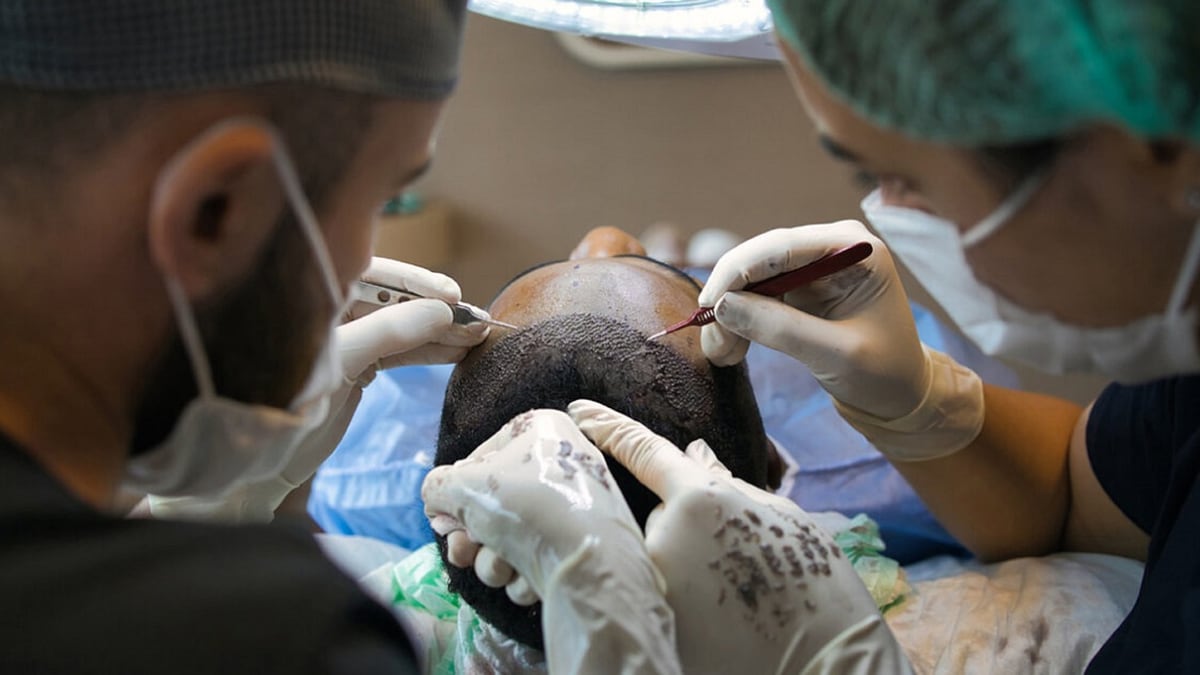 First Face Transplant With an Eye Reportedly Does Not Show Any Signs of Rejects After a Year