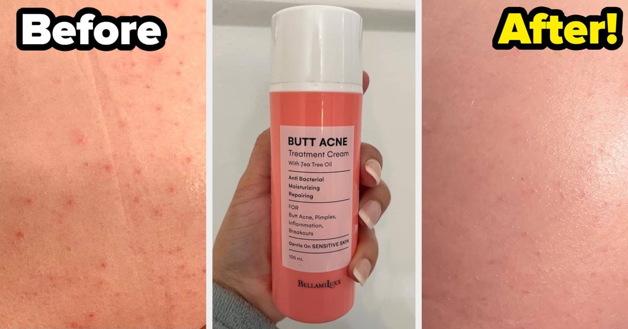 Jaw, Meet Floor: These 37 Personal Care Products Have Unbelievable Before And After Photos