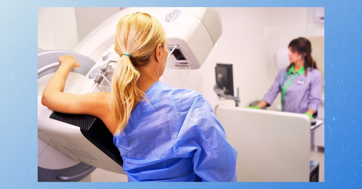 What to Expect at a Mammogram