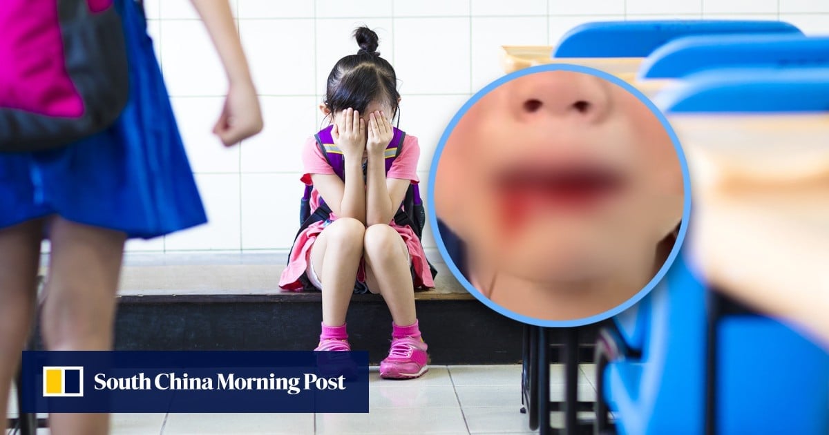 China dad criticised for not holding school bullies accountable after daughter bled from mouth