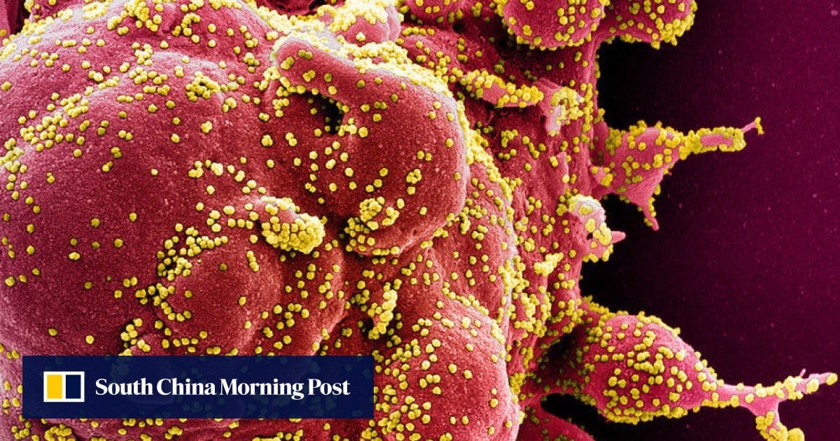 Chinese AI tool uncovers new viruses at the speed of a species per second: paper