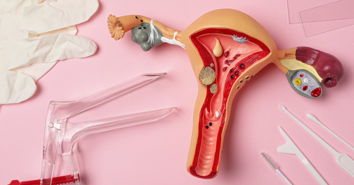 What to Expect at a Pap Smear