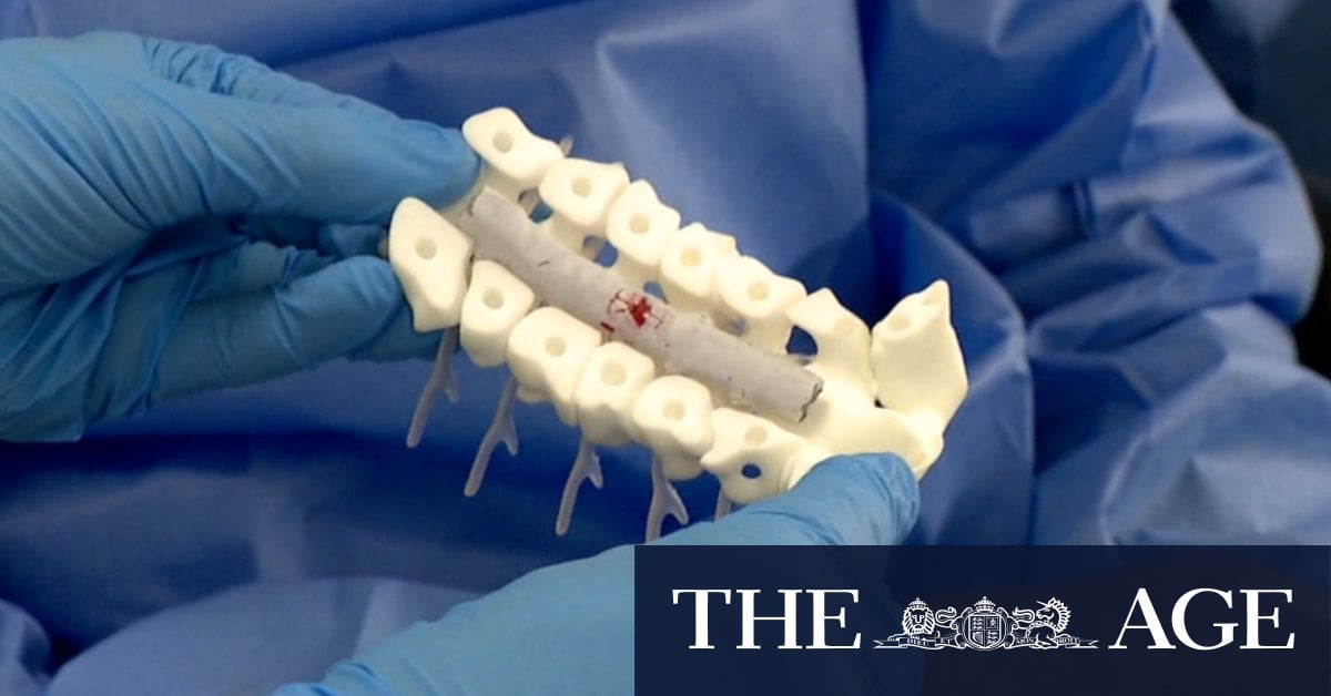 Hope for millions after spinal cord injury research breakthrough