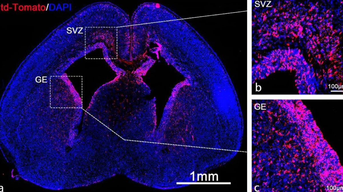 Innovative mRNA Delivery Technique Could Correct Genetic Disorders Before Birth