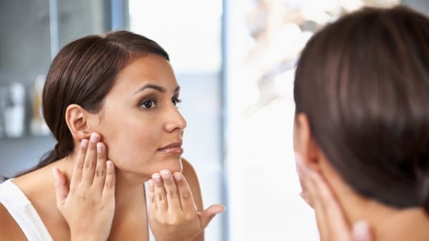 It's not the pizza, say dermatologists. What really causes acne breakouts