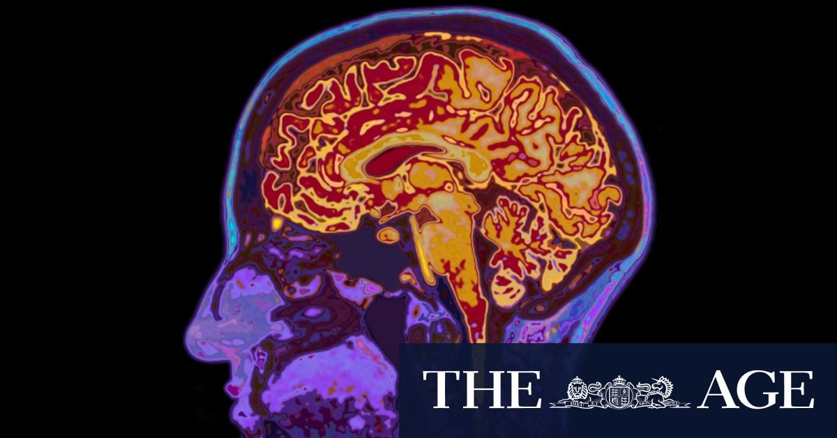 Left- and right-wing brains are wired differently. Can that gap be bridged?