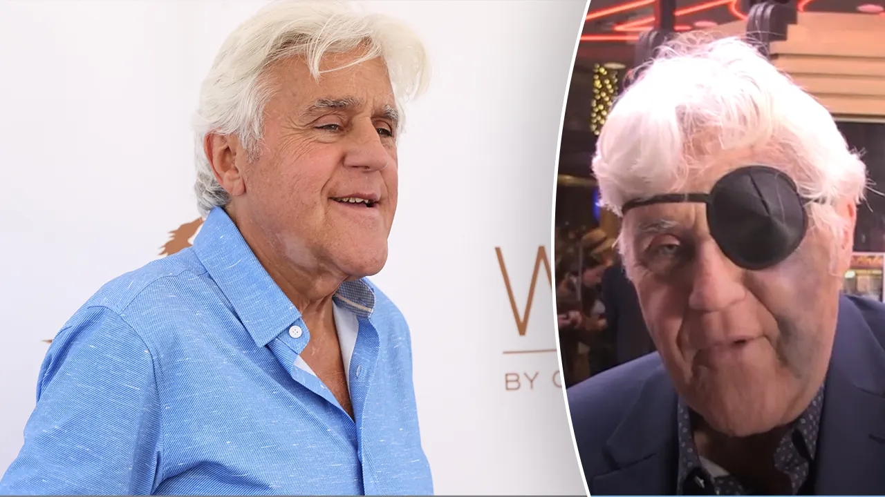 Jay Leno covers face injuries with eye patch after nasty fall