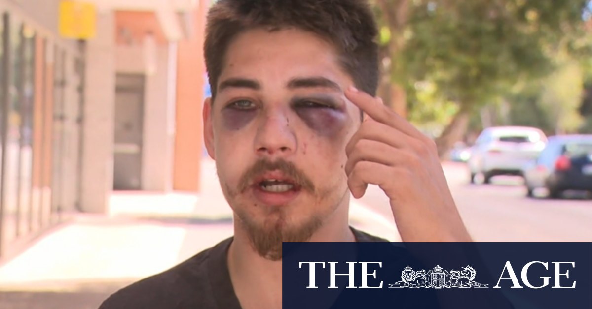 Perth father left with broken jaw after brutal attack