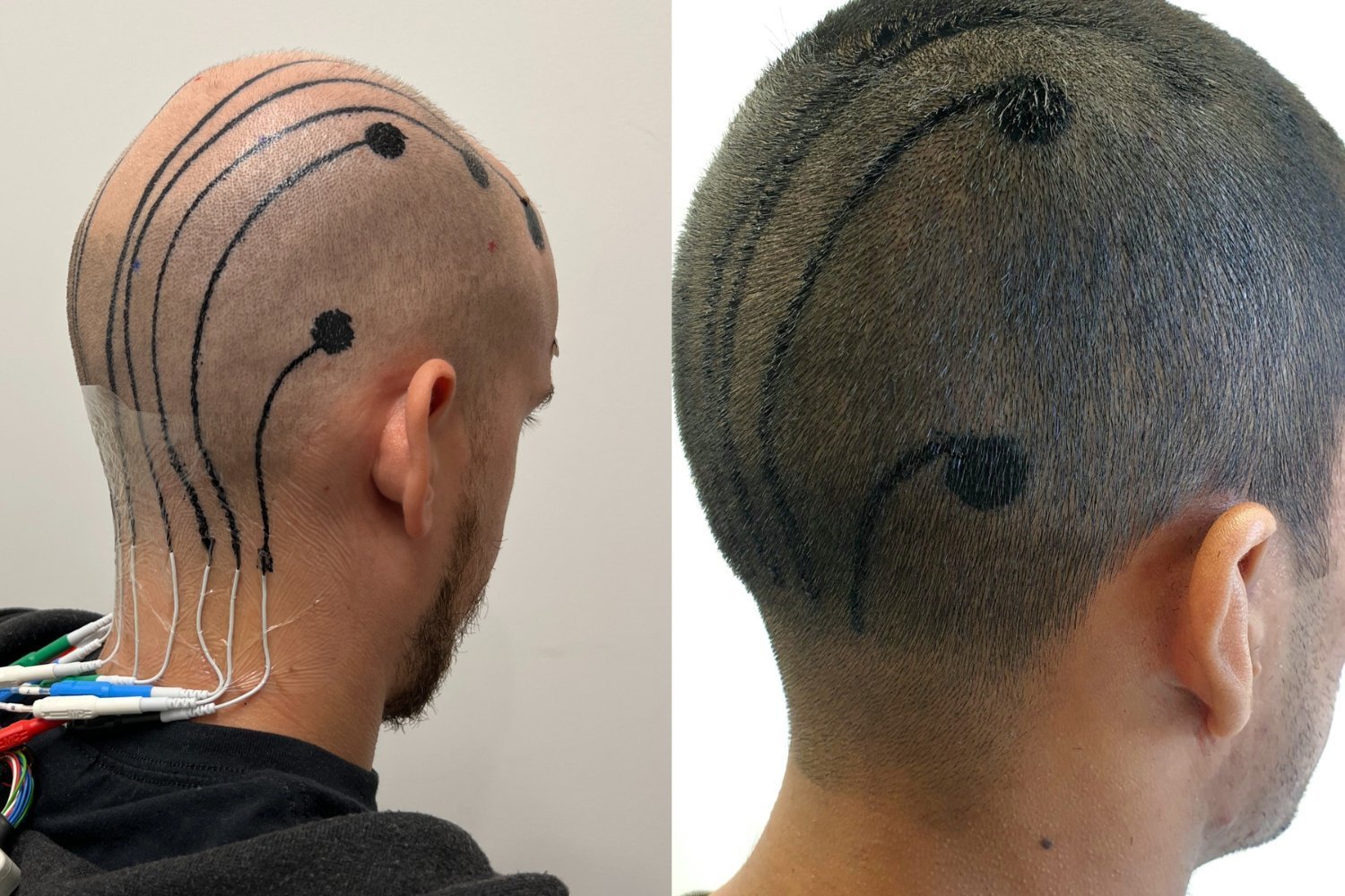 These Temporary Tattoos Can Read Your Brainwaves